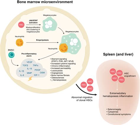 Defining Disease Modification In Myelofibrosis In The Era Of Targeted