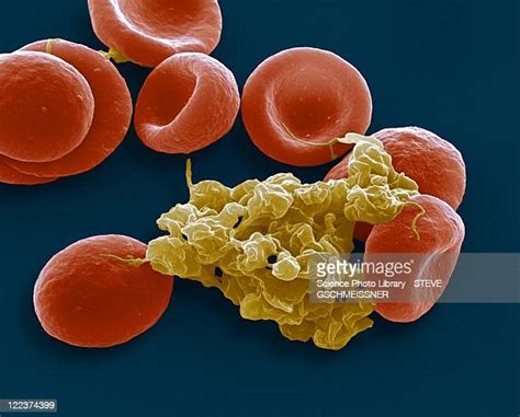 Red Blood Cell Micrograph Photos And Premium High Res Pictures Getty
