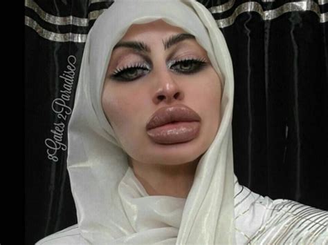 Big Lips Full Lips Bad Plastic Surgeries Plastic Surgery Beautiful