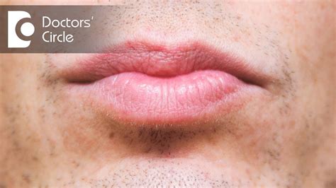 What Causes Black Around Lips Lipstutorial Org