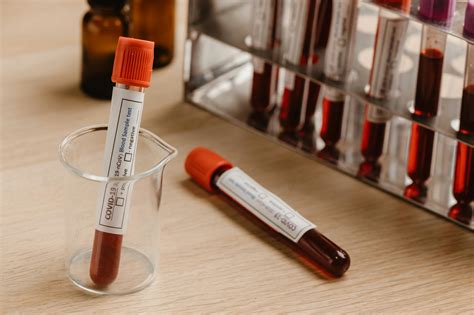 Close Up Photo Of A Blood Samples In A Blood Collection Tubes · Free