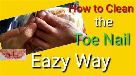 How To Clean The Toe Nail The Eazy Way Youtube