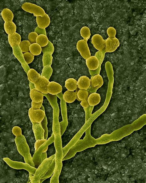 Mould Cladosporium Spp Hyphae And Spores Sem Stock Image F017
