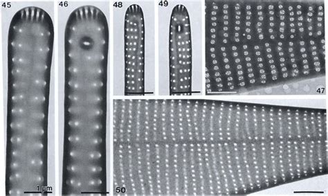 Synedropsis Hyperborea And S Hyperboreoides Tem All Of The Same