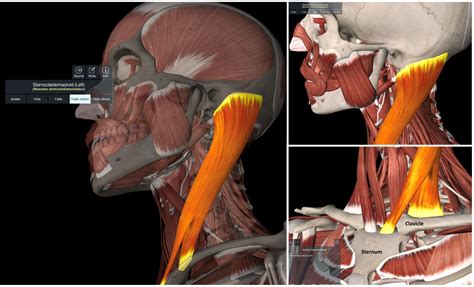 Sternocleidomastoid Syndrome What You Need To Know Regenexx