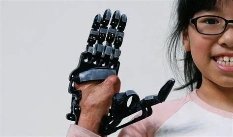 Print Your Own 3d Prosthetic Arm Hindustan Times