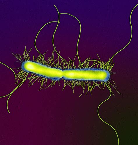 Proteus Vulgaris Bacteria Sem Photograph By Thomas Deerinck Ncmir
