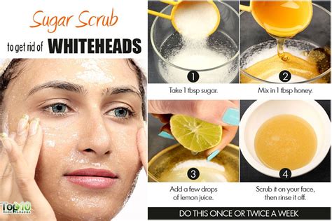 Home Remedies For Whiteheads Top 10 Home Remedies