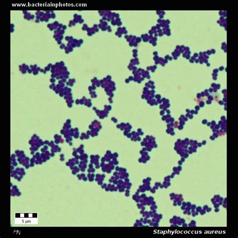 Staphylococcus Aureus Under Microscope Microscopy Of Gram Positive