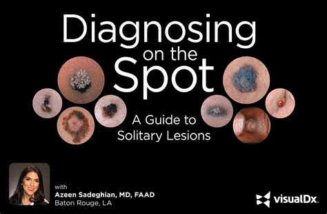 Diagnosing On The Spot A Guide To Solitary Lesions VisualDx