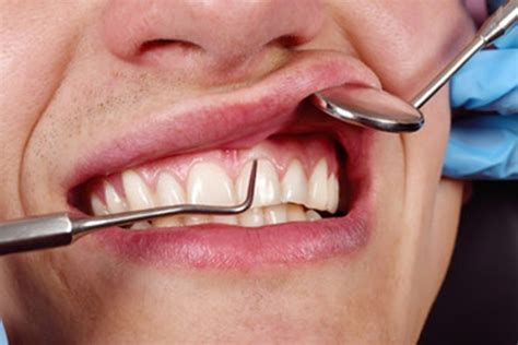 Causes Of Gum Overgrowth Cordini Periodontics