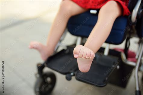Disabled Girl Sitting In Wheelchair Close Up Photo Of Her Legs