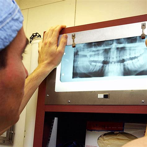 Photo Op Types Of Dental X Rays Wellness Dental