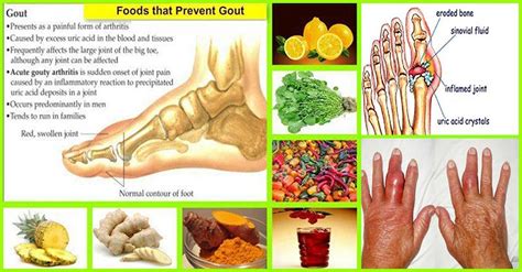 Adverse Effects Of Uric Acid To The Body And Natural Foods To Help Get