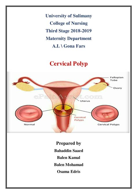 Pdf Cervical Polyp
