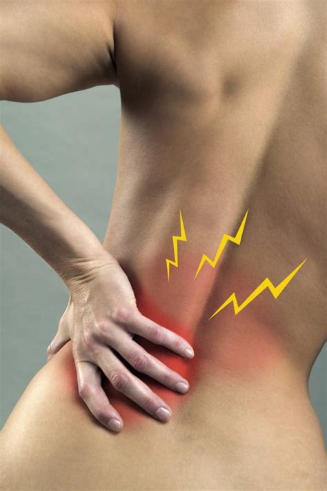 Mechanical Lower Back Pain Cause Symptoms Treatment Act Physiotherapy Health Services