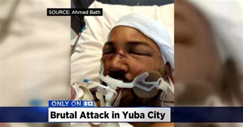 Brutal Beating Of Disabled Yuba City Man Likely Was Gang Violence Cbs