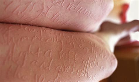 Artist Uses Her Own Skin As A Canvas Turning A Disease Into Art