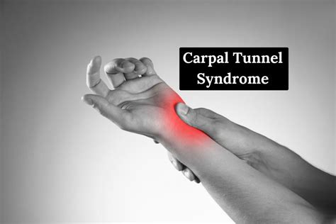 Carpal Tunnel Syndrome Symptoms Causes Diagnosis Go Lifestyle Wiki