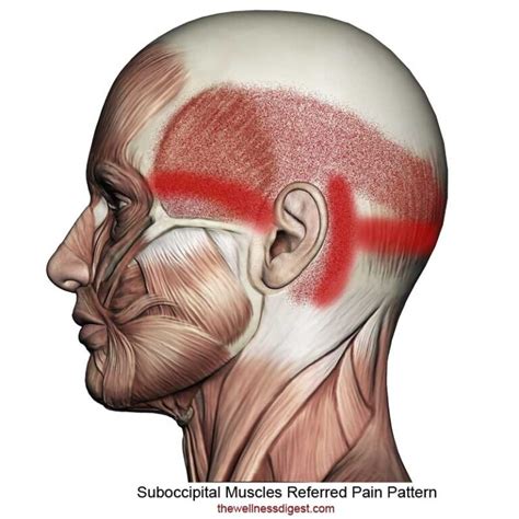 Suboccipital Muscles Headaches Migraines Eye Pain The Wellness Digest