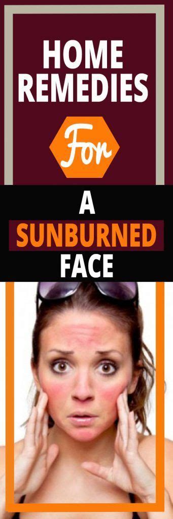 Home Remedies For A Sunburned Face Face Sunburn Remedies Sunburnt