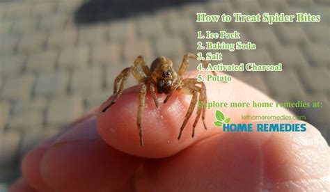 Home Remedies For Spider Bites Home Remedies For Spiders Home