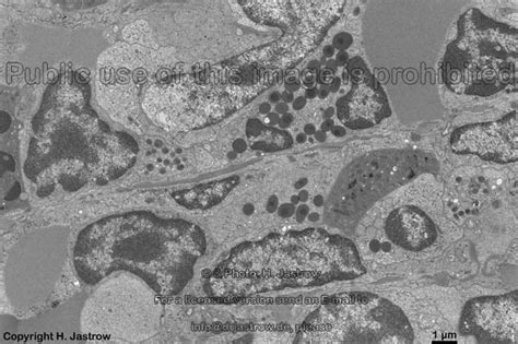 Basophile Granulocytes Drjastrows Electron Microscopic Atlas
