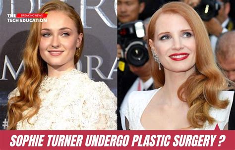 Did Sophie Turner Undergo Plastic Surgery Or Rumors Learn All The