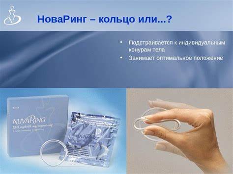 Кольцо новаринг лишний вес - фото презентация Картинка - Кольцо новаринг лишний вес - фото презентация