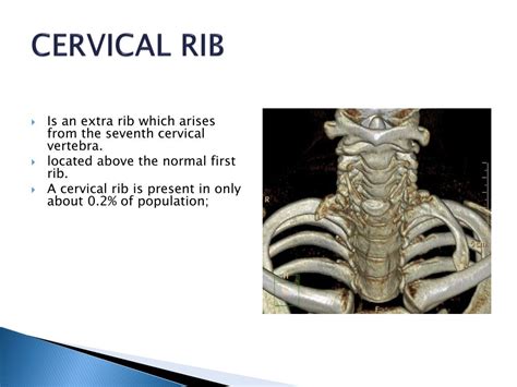 Ppt Neck Swelling Differential Diagnosis Powerpoint Presentation