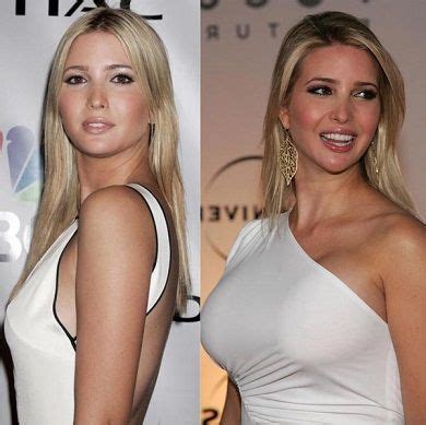 Pin On CelebLens Celebrity Plastic Surgery Before And After Photos