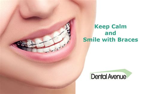 Dental Braces Can Align The Teeth And Its Process Depend On The Teeth Gap Visit Our Dental