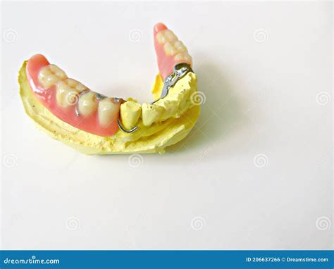 Removable Partial Denture For Lower Teeth Isolated On White Background