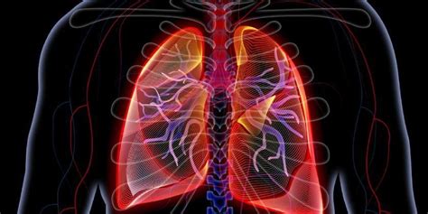 Enfermedad Pulmonar Intersticial Causas S Ntomas Y Tratamientos Remedios Caseros