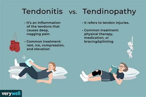 Tendonitis Causes How Long It Lasts And Other Conditions
