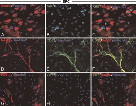 Nestin Expression In Endothelial Progenitor Cells Epcs Mouse Bone