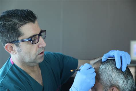 10 Best Hair Transplant Clinics In Turkey In 2022