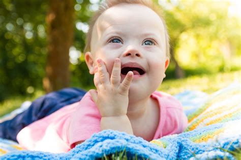 Iceland Aims To Eliminate Every Down Syndrome Child And They Are