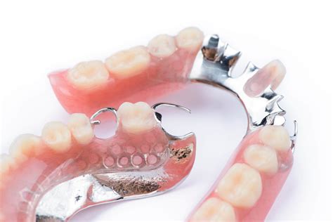 Prótesis Dentales Fijas Y Removibles Tipos Y Cuidados