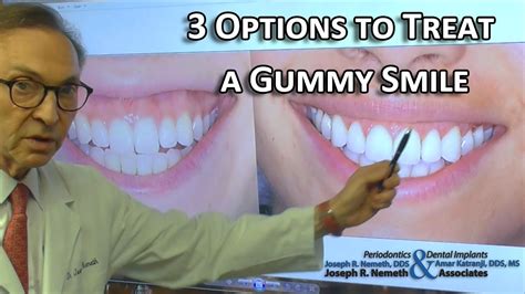 How To Fix Gummy Smile In Photoshop