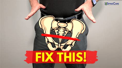 How To Self Correct A High Hip In SECONDS SpineCare Chiropractic