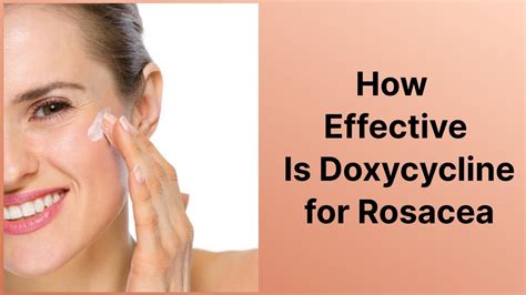 How Effective Is Doxycycline For Rosacea Youtube