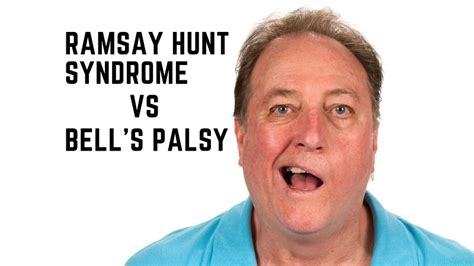 Ramsay Hunt Syndrome Vs Bells Palsy Expert Opinionz