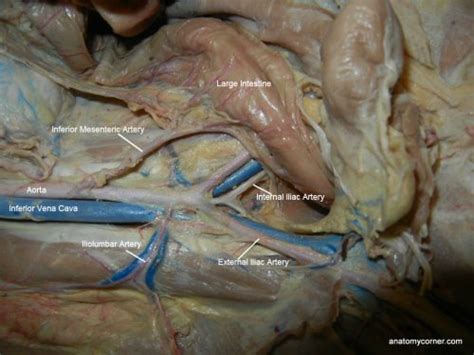 Blood vessels can be damaged by the effects of high blood glucose levels and this can in turn cause damage to organs, such as the heart and eyes, if significant blood vessel damage is sustained. Major Arteries and Veins of the Cat | Anatomy Corner