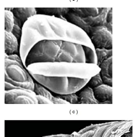 Ad Sem Micrographs Showing The Morphology Of Glandular Trichomes On