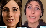 Chelsea Wolfe Teeth Fixed 2023, Before After Accident