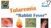 Tularemia (Rabbit Fever) | Causes, Pathogenesis, Forms, Symptoms ...