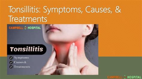 Tonsillitis Symptoms Causes And Treatments