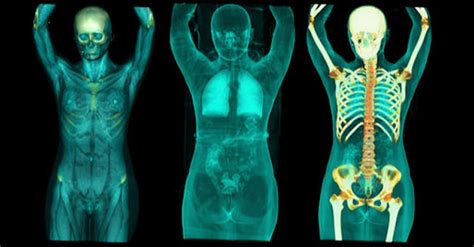 The number of ct scans performed annually is now more than 70 there are several key differences in a pet scan vs. Pet-CT Scan