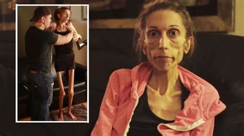 Anorexic Woman 37 Begs For Help In Powerful Youtube Video ‘im Ready